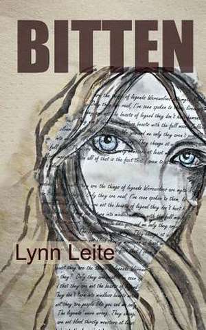 Bitten de Lynn Leite