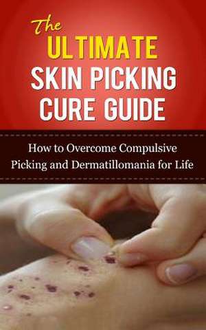 The Ultimate Skin Picking Cure Guide de Caesar Lincoln