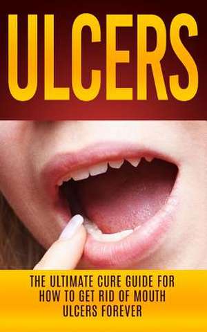 Ulcers de Wade Migan