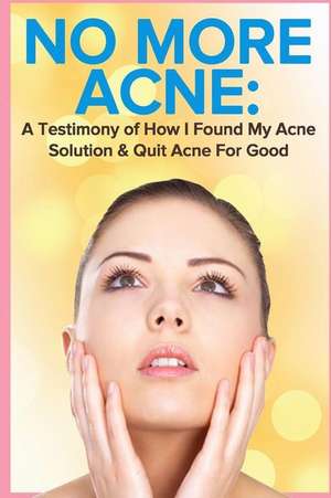 No More Acne de Amy Nicholas