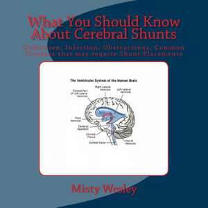 What You Should Know about Cerebral Shunts de Misty Lynn Wesley