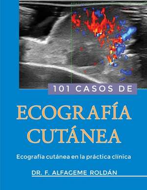 101 Casos de Ecografia Cutanea de Dr Fernando Alfageme Roldan