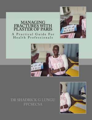 Managing Fractures with Plaster of Paris de Dr Shadrick G. Lungu