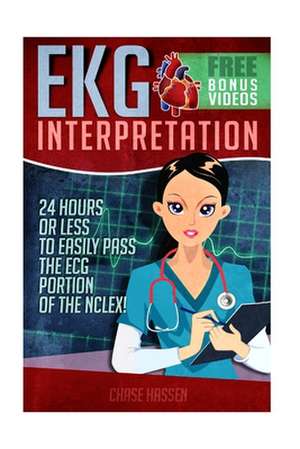 EKG Interpretation de Chase Hassen