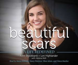 Beautiful Scars: A Life Redefined de Marie Hoffman