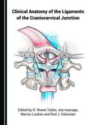 Clinical Anatomy of the Ligaments of the Craniocervical Junction