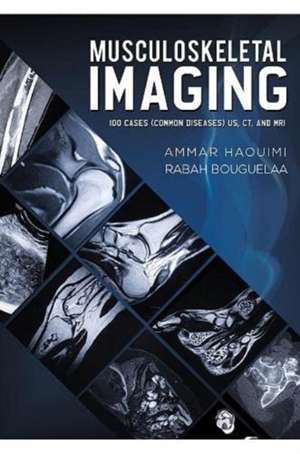 Musculoskeletal Imaging de Ammar Haouimi