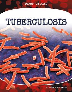Bozzone, D: Tuberculosis