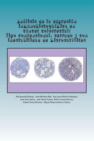 Analisis de La Expresion Inmunohistoquimica En Cancer Colorrectal de Ana Buendia Alcaraz