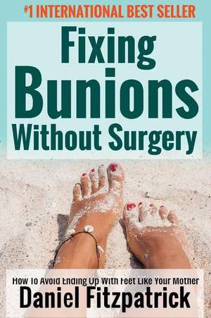 Fixing Bunions Without Surgery de MR Daniel Fitzpatrick