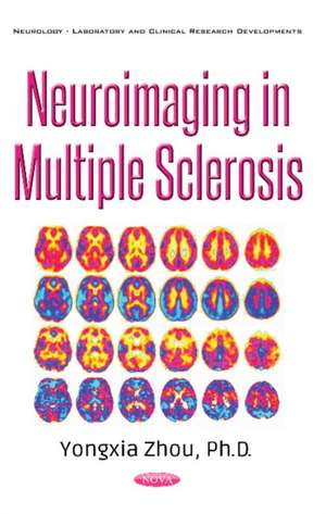 Neuroimaging in Multiple Sclerosis de Yongxia Zhou