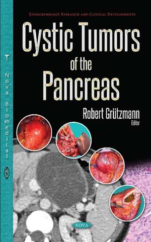 Cystic Tumors of the Pancreas de Robert Grtzmann