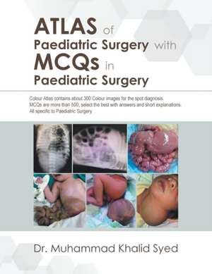 Atlas of Paediatric Surgery with Mcqs in Paediatric Surgery de Muhammad Khalid Syed