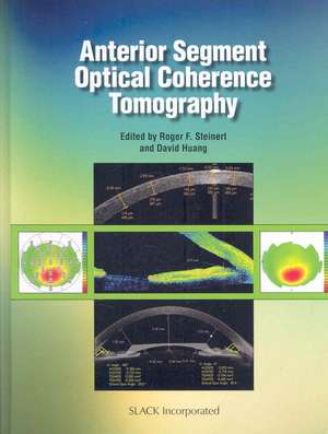 Anterior Segment Optical Coherence Tomography de Roger Steinert