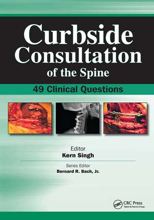 Curbside Consultation of the Spine: 49 Clinical Questions de Ken Singh