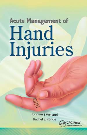 Acute Management of Hand Injuries de Andrew Weiland