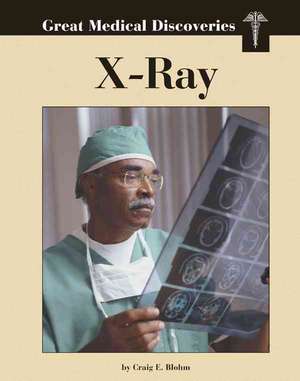 X-Rays de Craig E. Blohm