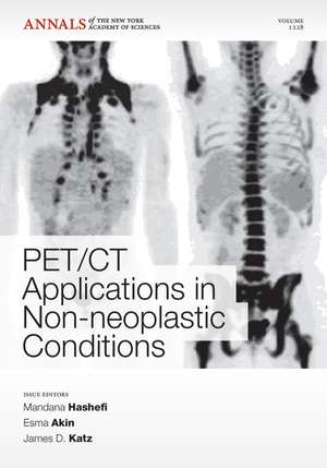 PET/CT Applications in Non–Neoplastic Conditions de M Hashefi