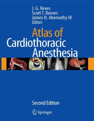 Atlas of Cardiothoracic Anesthesia de J. G. Reves