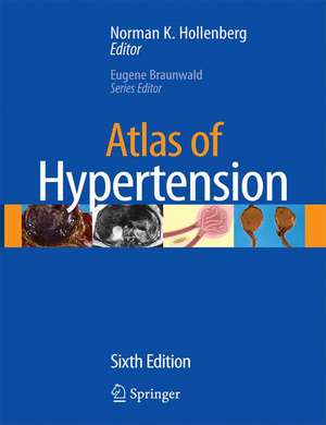 Atlas of Hypertension de Norman K. Hollenberg