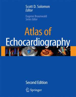 Atlas of Echocardiography de Scott D. Solomon