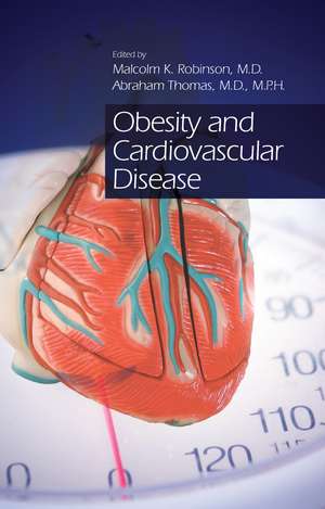 Obesity and Cardiovascular Disease de Malcolm K Robinson