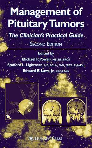 Management of Pituitary Tumors: The Clinician’s Practical Guide de Michael P. Powell