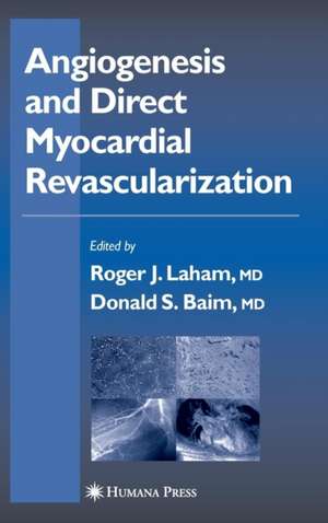 Angiogenesis and Direct Myocardial Revascularization de Roger J. Laham