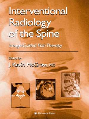 Interventional Radiology of the Spine: Image-Guided Pain Therapy de J. Kevin McGraw