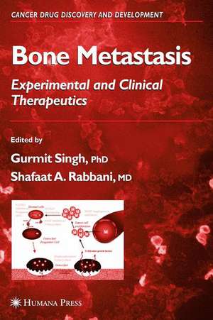 Bone Metastasis de Gurmit Singh