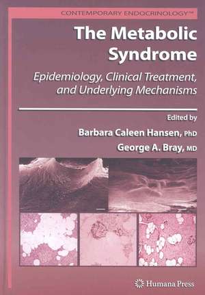 The Metabolic Syndrome:: Epidemiology, Clinical Treatment, and Underlying Mechanisms de Barbara C. Hansen