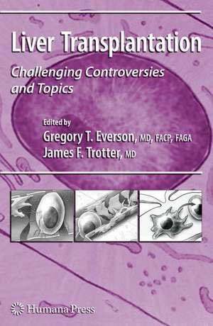 Liver Transplantation: Challenging Controversies and Topics de Gregory T. Everson