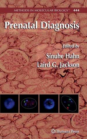 Prenatal Diagnosis de Sinuhe Hahn