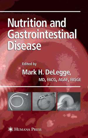 Nutrition and Gastrointestinal Disease de Mark DeLegge