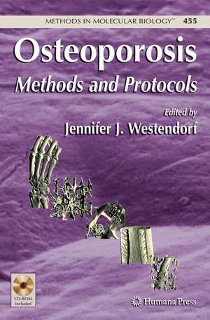 Osteoporosis: Methods and Protocols de Jennifer Westendorf