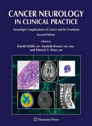 Cancer Neurology in Clinical Practice: Neurologic Complications of Cancer and Its Treatment de David Schiff