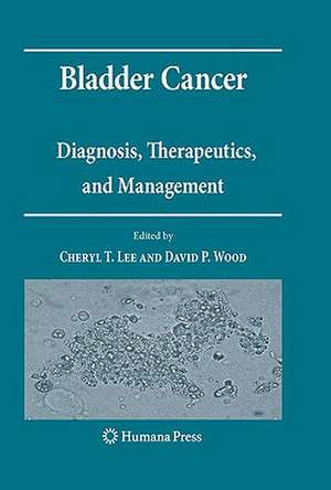 Bladder Cancer: Diagnosis, Therapeutics, and Management de Cheryl T. Lee