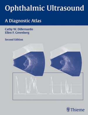 Ophthalmic Ultrasound – A Diagnostic Atlas de Cathy W. Dibernardo