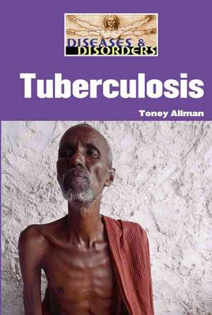 Tuberculosis de Toney Allman