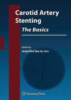 Carotid Artery Stenting: The Basics de Jacqueline Saw