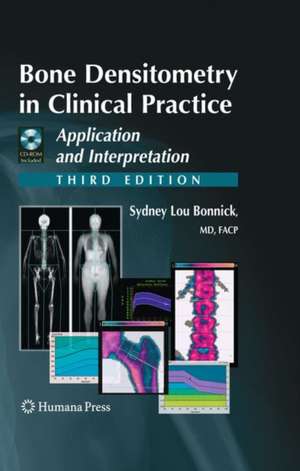 Bone Densitometry in Clinical Practice: Application and Interpretation de Sydney Lou Bonnick