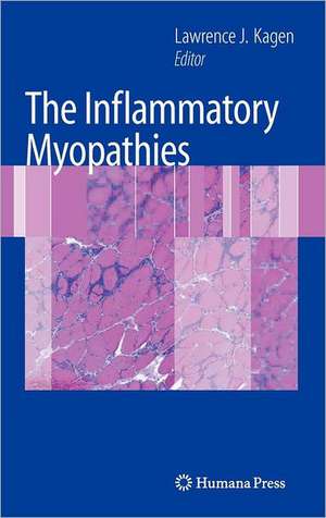 The Inflammatory Myopathies de Lawrence J. Kagen