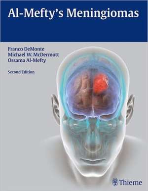 Al–Mefty`s Meningiomas de Franco DeMonte