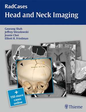 RadCases Head and Neck Imaging de Gaurang Shah