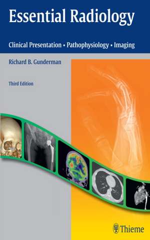 Essential Radiology – Clinical Presentation ⋅ Pathophysiology ⋅ Imaging de Richard B. Gunderman