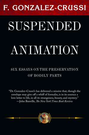 Suspended Animation: Six Essays on the Preservation of Bodily Parts de F. Gonzalez-Crussi