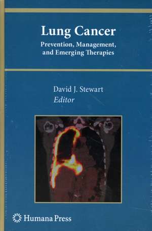Lung Cancer:: Prevention, Management, and Emerging Therapies de David J. Stewart