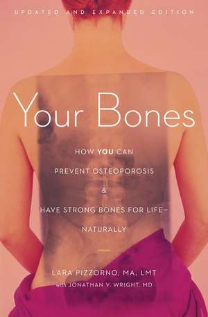 Your Bones: How You Can Prevent Osteoporosis & Have Strong Bones for Life - Naturally de Lara Pizzorno