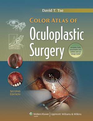 Color Atlas of Oculoplastic Surgery de David T. Tse