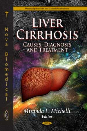 Liver Cirrhosis de Miranda L. Michelli